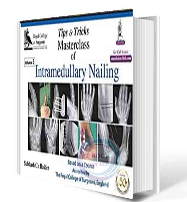 دانلود کتابTIPS & TRICKS MASTERCLASS OF INTERLOCKING NAILING 3VOLS 2021 (ORIGINAL PDF)